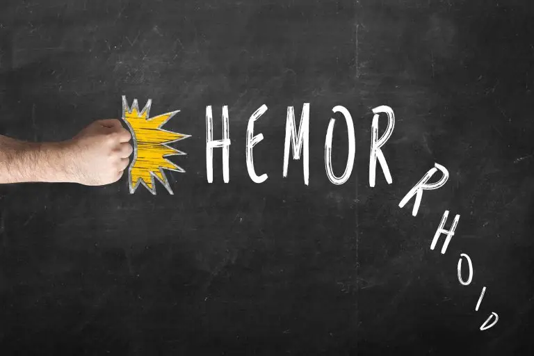 Severidad y tipos de hemorroides internas